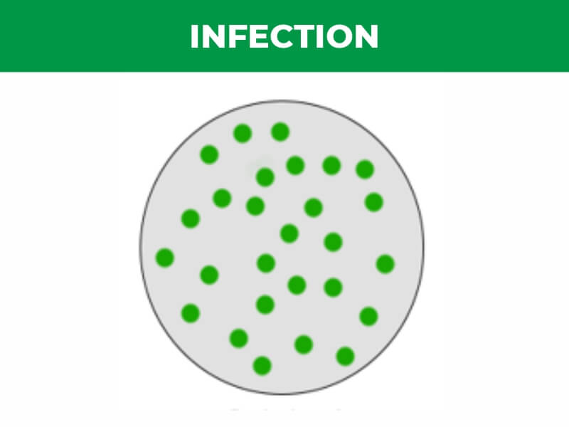 Infection